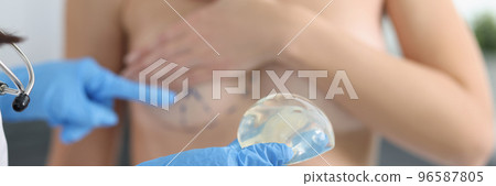 Doctor hold silicone breast implant, point on marking on clients body, lady topless in clinic office 96587805