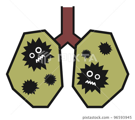 Illustration of an unhealthy lung with an infection found in a medical examination 96593945