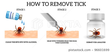 realistic spider mite remove infographics 96601699