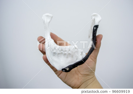 Person holding in hand 3D printed plastic prototype human lower jaw and medical titanium implant close-up. Prosthesis anatomical bone 3D printed from metal powder. Orthopedic maxillo-facial prosthesis Person holding in hand 3D printed plastic prototype human lower jaw and medical titanium implant close-up. Prosthesis anatomical bone 3D printed from metal powder. Orthopedic maxillo-facial prosthesis 96609919