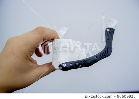 Person holding in hand 3D printed plastic prototype human lower jaw and medical titanium implant close-up. Prosthesis anatomical bone 3D printed from metal powder. Orthopedic maxillo-facial prosthesis Person holding in hand 3D printed plastic prototype human lower jaw and medical titanium implant close-up. Prosthesis anatomical bone 3D printed from metal powder. Orthopedic maxillo-facial prosthesis 96609923