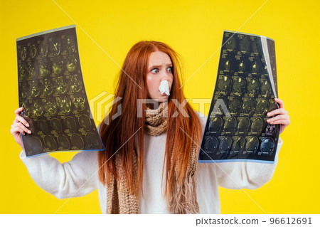 unwell redhaired ginger woman runny nose wearing knitted sweater and scarf with many pills in hand in studio yellow background unwell redhaired ginger woman runny nose wearing knitted sweater and scarf with many pills in hand in studio yellow background 96612691