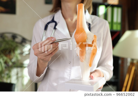 Doctor traumatologist showing ligaments and muscles on artificial model of human knee joint closeup Doctor traumatologist showing ligaments and muscles on artificial model of human knee joint closeup 96652002