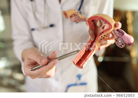 Doctor gynecologist explaining how female genital organs are arranged on artificial uterus model closeup Doctor gynecologist explaining how female genital organs are arranged on artificial uterus model closeup 96652003