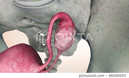 Ovarian cancer cell 3d medical 96686693
