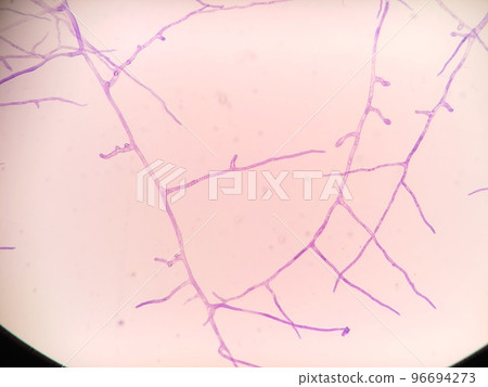 黴菌的菌絲是如何生長的 96694273
