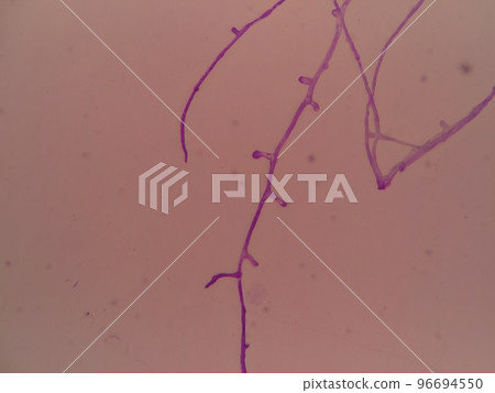 真菌菌絲上出現芽 96694550