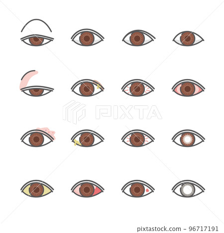 12種眼疾圖標 12種眼疾圖標 96717191
