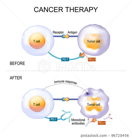 Cancer therapy of monoclonal antibodies Cancer therapy of monoclonal antibodies 96728456