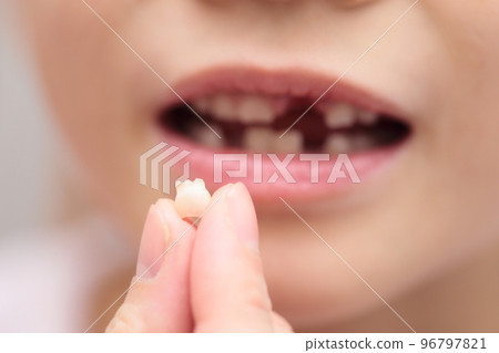 乳牙和恆牙都換過的小學生 96797821