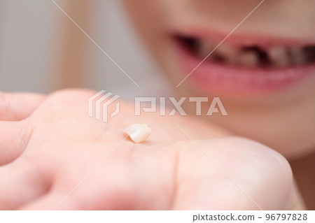 乳牙和恆牙都換過的小學生 96797828