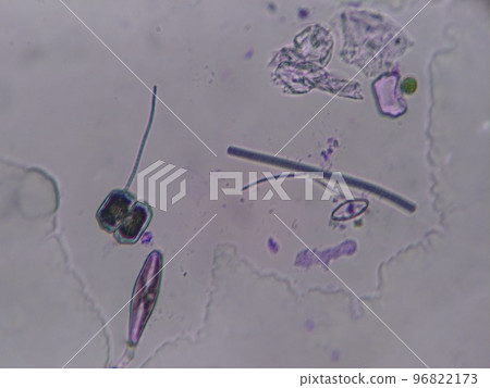 淡水浮游生物的顯微照片 淡水浮游生物的顯微照片 96822173