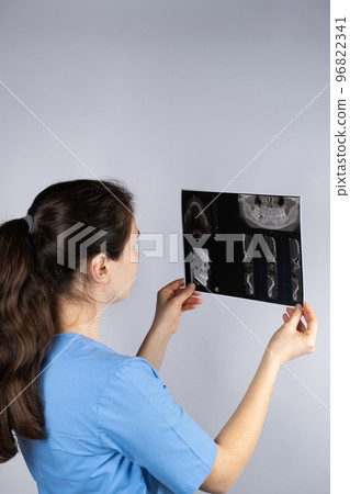 The doctor holds a CT scan of a patient with temporomandibular joint dysfunction and malocclusion. The doctor holds a CT scan of a patient with temporomandibular joint dysfunction and malocclusion. 96822341
