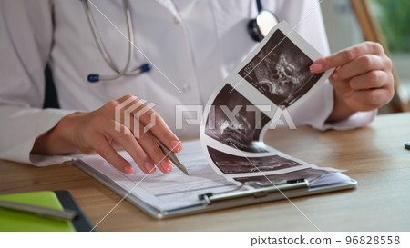 Female doctor analyzes ultrasound results for patient diagnosis. Female doctor analyzes ultrasound results for patient diagnosis. 96828558