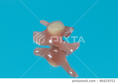 Artificial tooth prosthesis in on a blue background. Single removable prosthesis to replace a real tooth, an alternative to dental implantation in dentistry 96829352