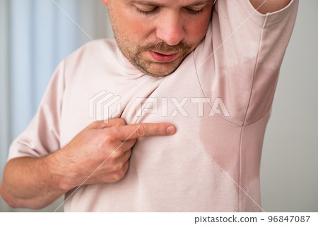 Man with hyperhidrosis sweating very badly under armpit Man with hyperhidrosis sweating very badly under armpit 96847087