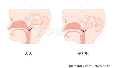成人和兒童耳道圖解_矢狀切面 96926616