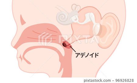 Illustration of a child's eustachian tube and enlarged adenoids_sagittal section_with letters Illustration of a child's eustachian tube and enlarged adenoids_sagittal section_with letters 96926828