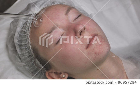 A beautician makes a darsonvalization of the face of a young girl with problem skin. 96957284