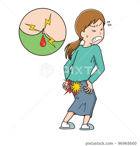 A woman with painful warts and hemorrhoids 96968600