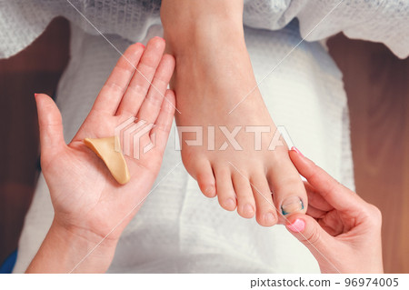 Orthopedist shows a silicone impression on the hand to correct an ingrown toenail on the client's big toe. Close-up. Top view. The concept of podology and chiropody 96974005