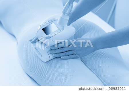Woman in special white suit getting anti cellulite massage in a spa salon. LPG, and body contouring treatment in clinic. Woman in special white suit getting anti cellulite massage in a spa salon. LPG, and body contouring treatment in clinic. 96983911
