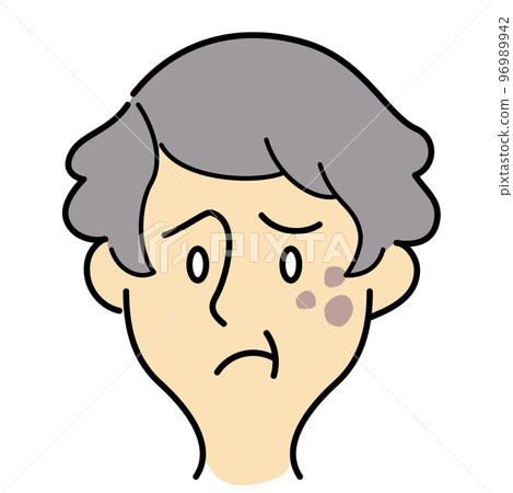 Skin troubles of elderly women with short hair Skin troubles of elderly women with short hair 96989942