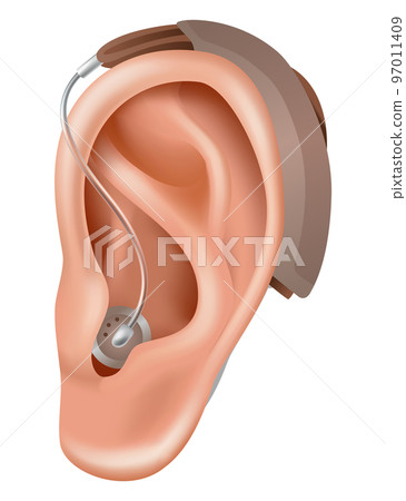 Hearing aid. Sound amplifier for patients with hearing loss. Medicine and health. Realistic object behind the ear. Treatment and prosthetics in otolaryngology 97011409