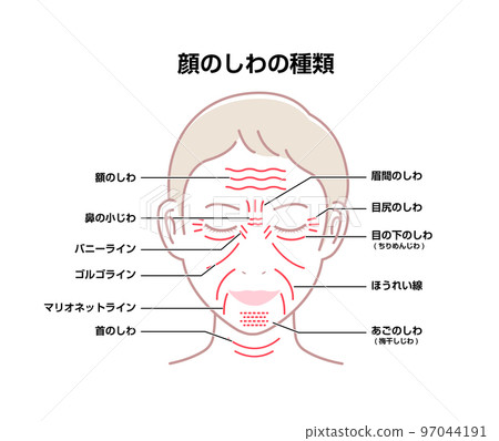 Wrinkles on a woman's face (location and name) Vector illustration Wrinkles on a woman's face (location and name) Vector illustration 97044191