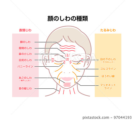 Female face wrinkles (facial expression wrinkles and sagging wrinkles) vector illustration 97044193
