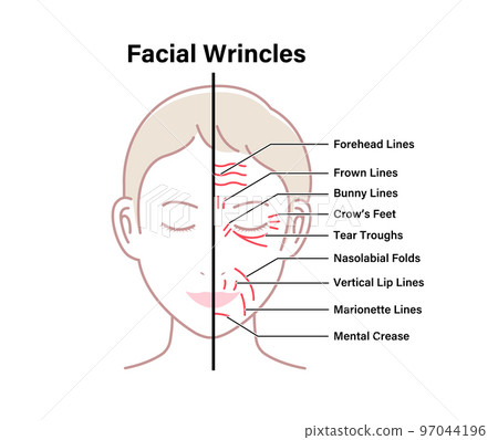 Wrinkles on female face (location and name) Vector illustration (comparison with wrinkle-free face) / English Wrinkles on female face (location and name) Vector illustration (comparison with wrinkle-free face) / English 97044196