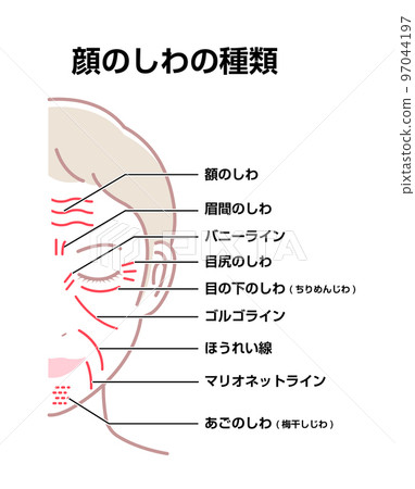 女人的臉上的皺紋(位置和名稱)矢量圖 女人的臉上的皺紋(位置和名稱)矢量圖 97044197