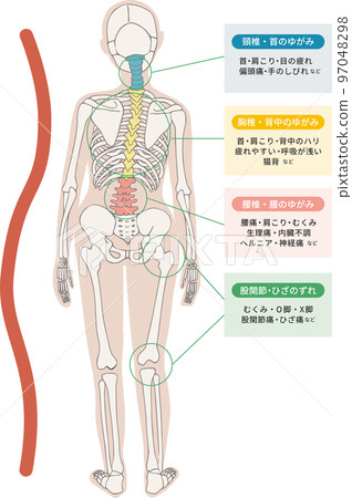 Illustrative illustrations of physical symptoms caused by distortion and misalignment of the spine, cervical spine, thoracic spine, and lumbar spine. 97048298