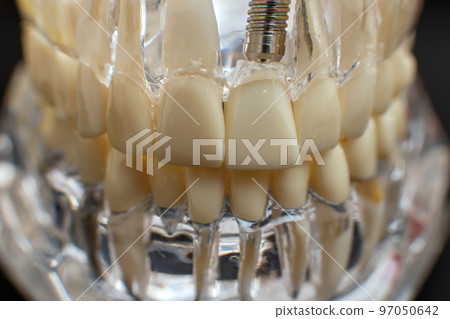 Dentist dental prosthetic teeth, gums, roots close-up. Studying dental diseases concept Dentist dental prosthetic teeth, gums, roots close-up. Studying dental diseases concept 97050642