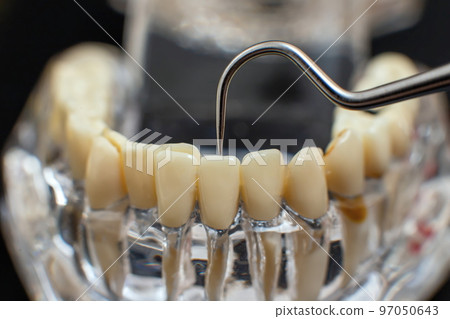 Dentist dental prosthetic teeth, gums, roots close-up. Studying dental diseases concept Dentist dental prosthetic teeth, gums, roots close-up. Studying dental diseases concept 97050643