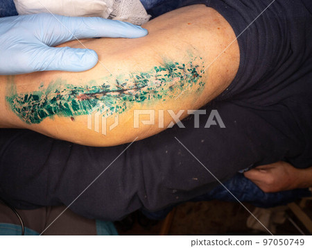 Knee joint replacement. Interview between doctor and patient regarding mobility Knee joint replacement. Interview between doctor and patient regarding mobility 97050749