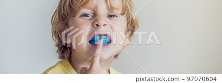 Three-year old boy shows myofunctional trainer to illuminate mouth breathing habit. Helps equalize the growing teeth and correct bite. Corrects the position of the tongue BANNER, long format Three-year old boy shows myofunctional trainer to illuminate mouth breathing habit. Helps equalize the growing teeth and correct bite. Corrects the position of the tongue BANNER, long format 97070604