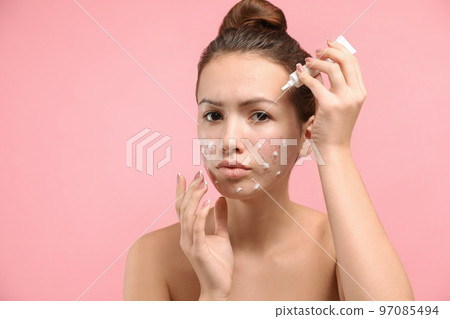 Teen girl with acne problem applying cream on light pink background Teen girl with acne problem applying cream on light pink background 97085494