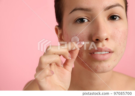 Teen girl applying acne healing patch on light pink background 97085700