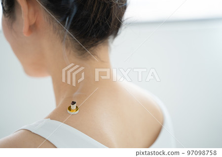 艾灸肩膀 艾灸肩膀 97098758