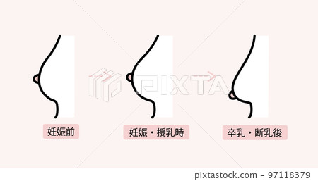 Illustration of postpartum bust sagging Illustration of postpartum bust sagging 97118379