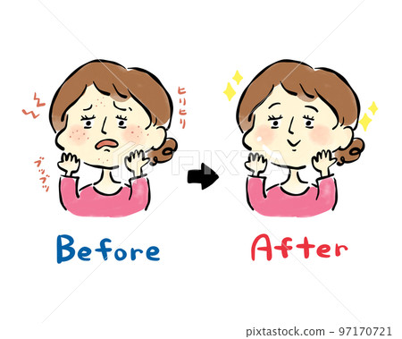 一個女人患粉刺、皮膚問題前後的手繪插圖素材 97170721
