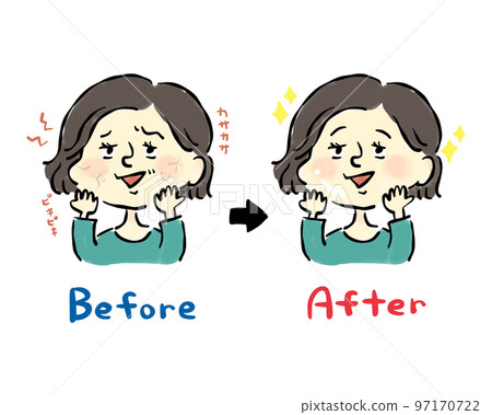 患皮膚乾燥症前後皮膚問題的女性手繪插畫素材 97170722