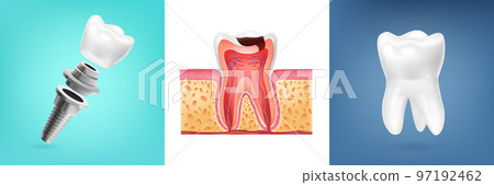 Tooth Anatomy Design Concept 97192462