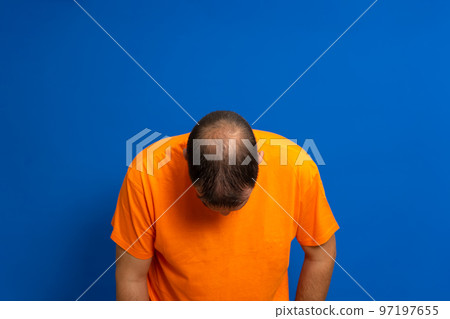 Man in an orange t-shirt leaning his head forward to reveal his bald spot, isolated on blue studio background. Man in an orange t-shirt leaning his head forward to reveal his bald spot, isolated on blue studio background. 97197655