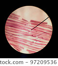 Micrograph of the neuromuscular junction 97209536