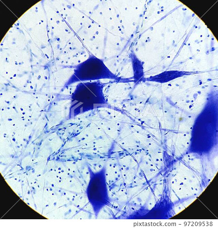 Photomicrograph of nerve cells 97209538