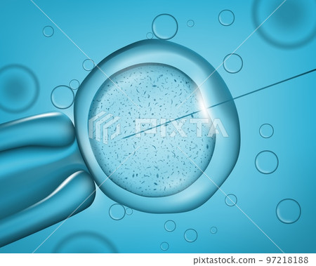 Laser needle injection to cell. Medical operation. Human DNA research, biotechnology and medicine science, artificial insemination realistic vector background with needle in cell under microscope 97218188