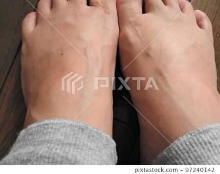 Leg blood vessels Female legs Female instep Female 97240142