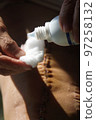 Surgical suture on the knee. Surgical wound sutured with special metal suture for healing. Total knee joint replacement. Close-up. 97258132